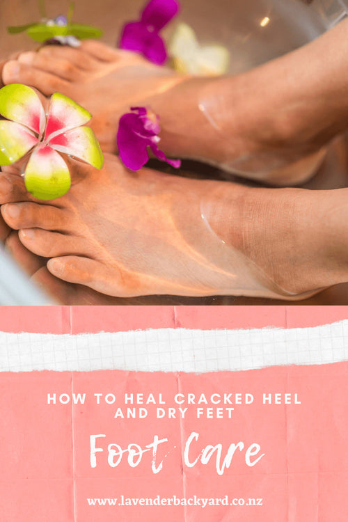 How to Care for Cracked Heels and Dry Feet